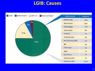 LGIB: Causes
32
 