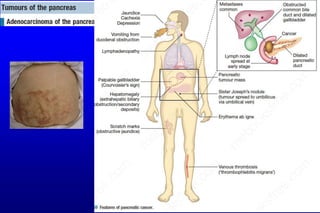 Git 4th pancreatic disorders21