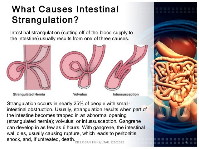 Que tomar para regular el transito intestinal