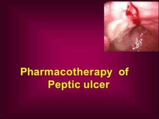 Pharmacotherapy of
Peptic ulcer
 