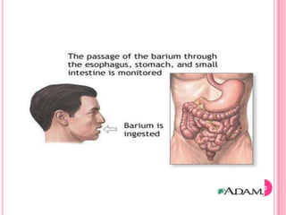 Disadvantage: It cannot be used to examine structures that lie behind bony tissue….