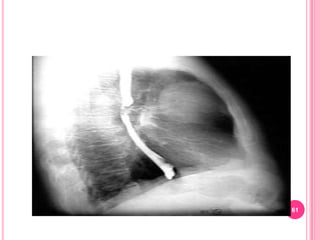 Endoscopic ultrasonography – gives direct imaging of a target area.