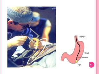 NPO after midnight before the test.