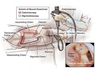 To detect presence of polyps, tumors and other lesions of small intestine and demonstrate abnormal anatomy or malfunction of the bowel.