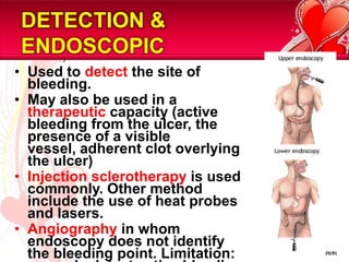 DETECTION &
ENDOSCOPIC
• Used to detect the site of
  bleeding.
• May also be used in a
  therapeutic capacity (active
  bleeding from the ulcer, the
  presence of a visible
  vessel, adherent clot overlying
  the ulcer)
• Injection sclerotherapy is used
  commonly. Other method
  include the use of heat probes
  and lasers.
• Angiography in whom
  endoscopy does not identify
  the bleeding point. Limitation:   29/81
 