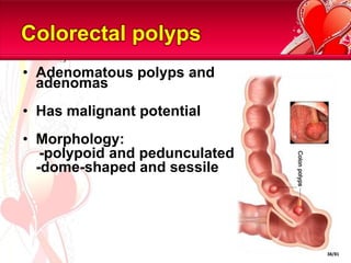 Colorectal polyps
• Adenomatous polyps and
  adenomas
• Has malignant potential
• Morphology:
   -polypoid and pedunculated
  -dome-shaped and sessile




                                38/81
 