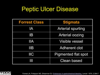 Peptic Ulcer Disease
Forrest Class Stigmata
IA Arterial spurting
IB Arterial oozing
IIA Visible vessel
IIB Adherent clot
IIC Pigmented flat spot
III Clean based
Forrest JA, Finlayson ND, Shearman DJ: Endoscopy in gastrointestinal bleeding. Lancet 1974; 2:394-7
 