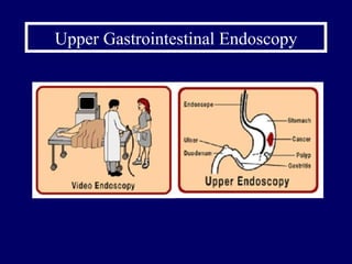 Upper Gastrointestinal Endoscopy 