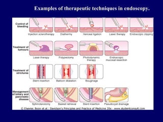 Examples of therapeutic techniques in endoscopy. 