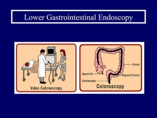 Lower Gastrointestinal Endoscopy 
