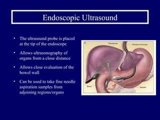 Endoscopic Ultrasound The ultrasound probe is placed at the tip of the endoscope Allows ultrasonography of organs from a close distance Allows close evaluation of the bowel wall Can be used to take fine needle aspiration samples from adjoining regions/organs 