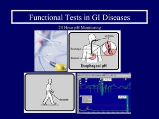 Functional Tests in GI Diseases 24 Hour pH Monitoring 