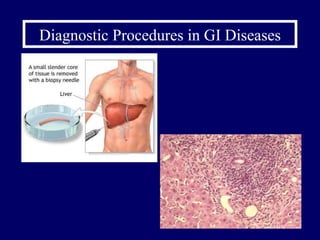 Diagnostic Procedures in GI Diseases 