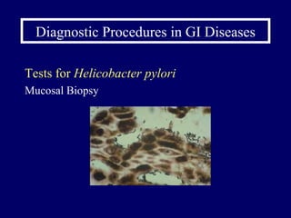 Diagnostic Procedures in GI Diseases Tests for  Helicobacter pylori Mucosal Biopsy 