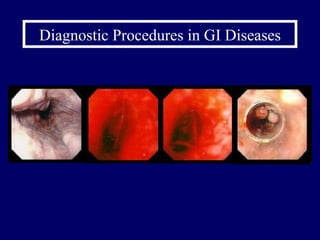 Diagnostic Procedures in GI Diseases 