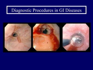 Diagnostic Procedures in GI Diseases 