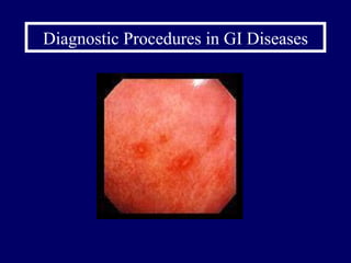 Diagnostic Procedures in GI Diseases 