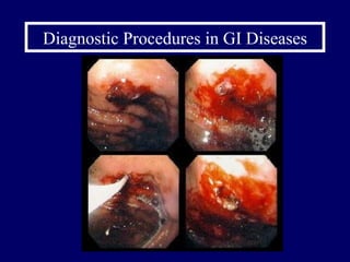 Diagnostic Procedures in GI Diseases 