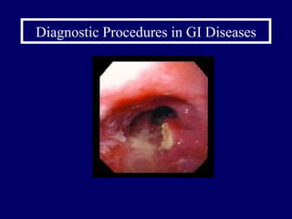 Diagnostic Procedures in GI Diseases 