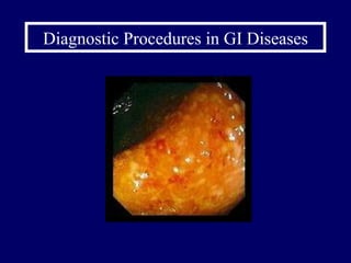Diagnostic Procedures in GI Diseases 