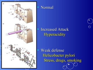Normal Increased Attack   Hyperacidity Weak defense   Helicobacter pylori   Stress, drugs, smoking 