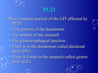 PUD Most common portion of the GIT affected by PUD: First portion of the duodenum  The antrum of the stomach  The gastroesophageal junction  Ulcer is in the duodenum called duodenal ulcer (DU) Ulcer is found in the stomach called gastric ulcer (GU) 
