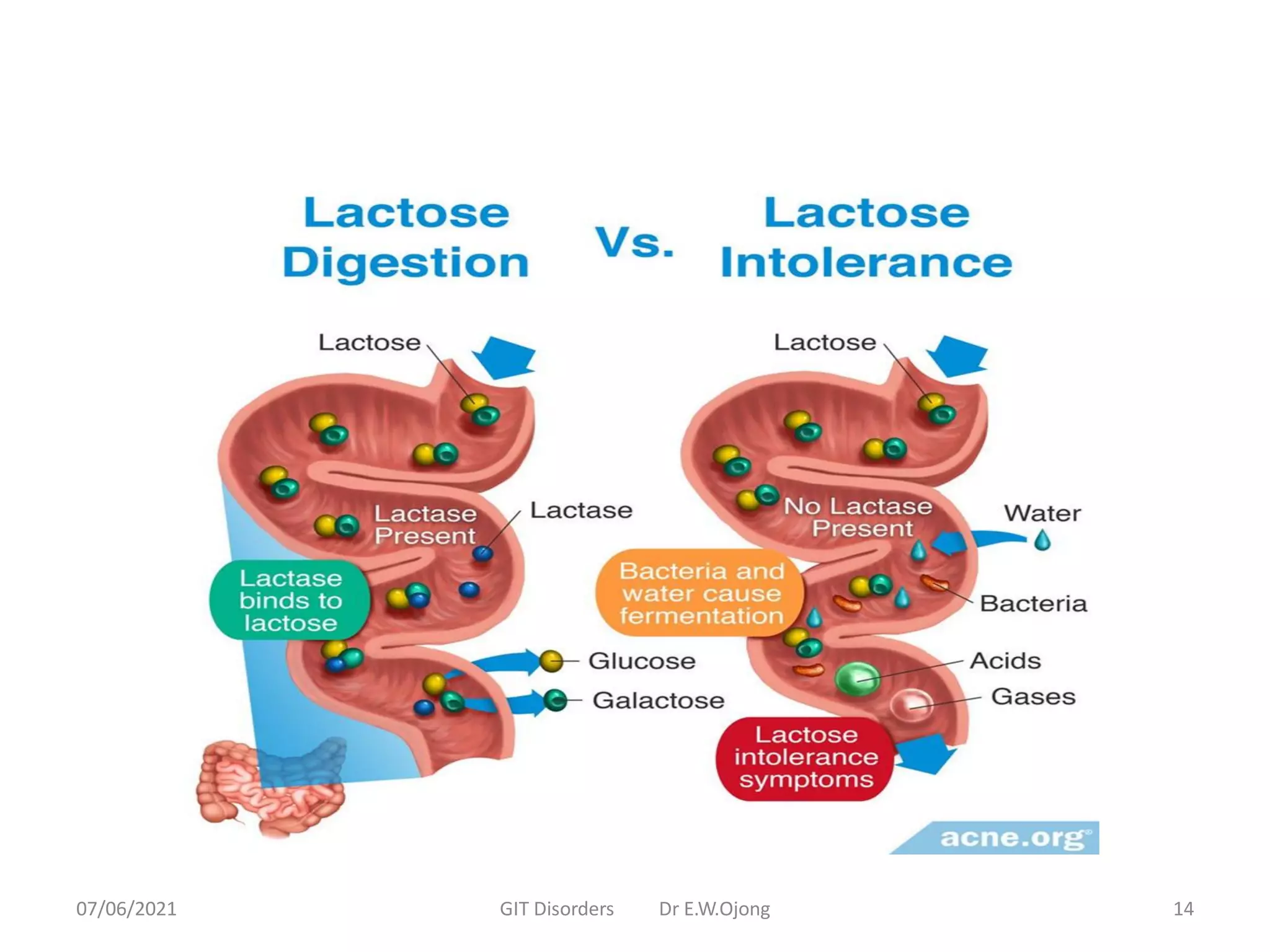 07/06/2021 GIT Disorders Dr E.W.Ojong 14
 