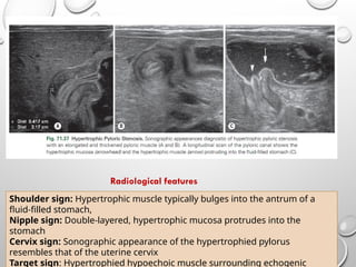 Embryology of the Gastrointestinal Tract with Radiological Correlation ...