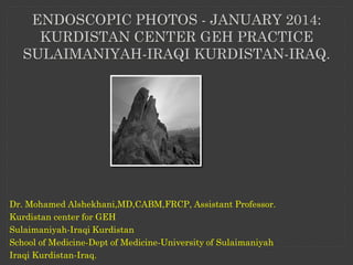 ENDOSCOPIC PHOTOS - JANUARY 2014:
KURDISTAN CENTER GEH PRACTICE
SULAIMANIYAH-IRAQI KURDISTAN-IRAQ.

Dr. Mohamed Alshekhani,MD,CABM,FRCP, Assistant Professor.
Kurdistan center for GEH
Sulaimaniyah-Iraqi Kurdistan
School of Medicine-Dept of Medicine-University of Sulaimaniyah
Iraqi Kurdistan-Iraq.

 