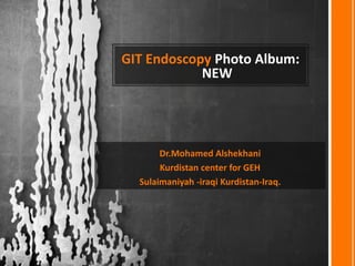 GIT Endoscopy Photo Album:
NEW
Dr.Mohamed Alshekhani
Kurdistan center for GEH
Sulaimaniyah -iraqi Kurdistan-Iraq.
 