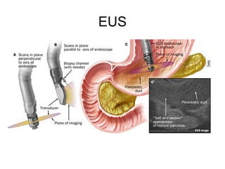 EUS 