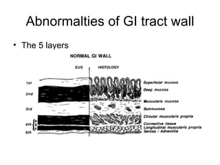 Abnormalties of GI tract wall The 5 layers 