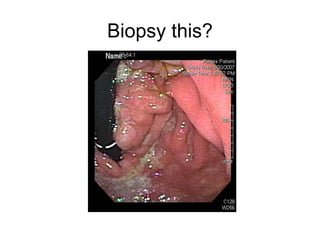 Biopsy this? 
