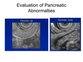 Evaluation of Pancreatic Abnormalties 