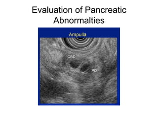 Evaluation of Pancreatic Abnormalties 