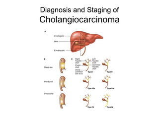 Diagnosis and Staging of Cholangiocarcinoma 