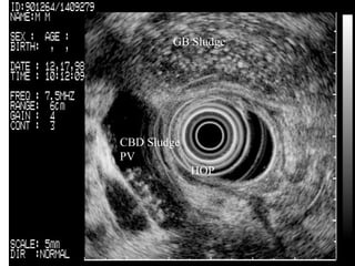 CBD Sludge  PV  HOP   GB Sludge   