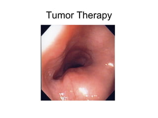 Tumor Therapy 