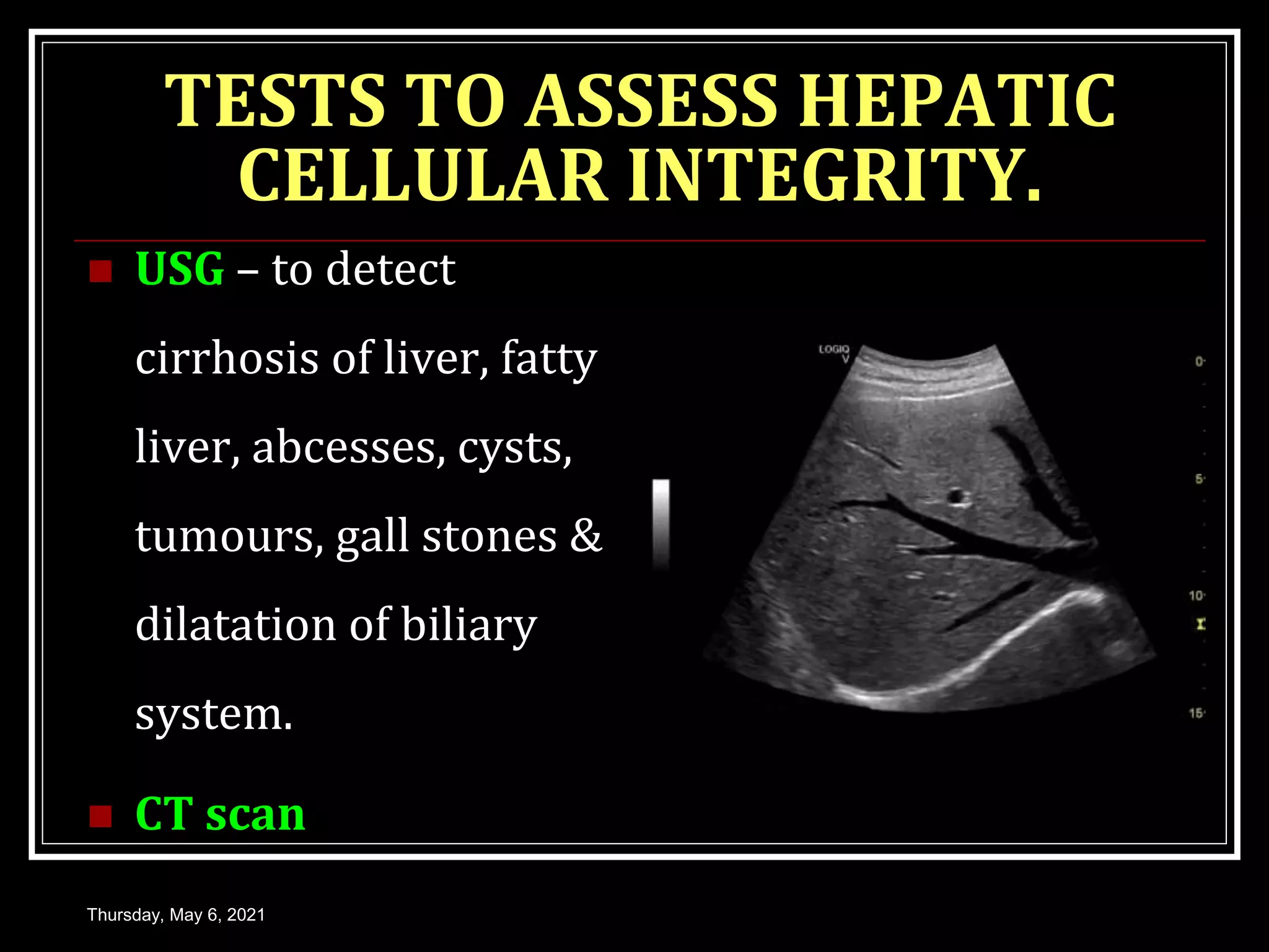 TESTS TO ASSESS HEPATIC
CELLULAR INTEGRITY.
 USG – to detect
cirrhosis of liver, fatty
liver, abcesses, cysts,
tumours, gall stones &
dilatation of biliary
system.
 CT scan
Thursday, May 6, 2021
 
