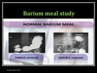 Barium meal study
Thursday, May 6, 2021
 