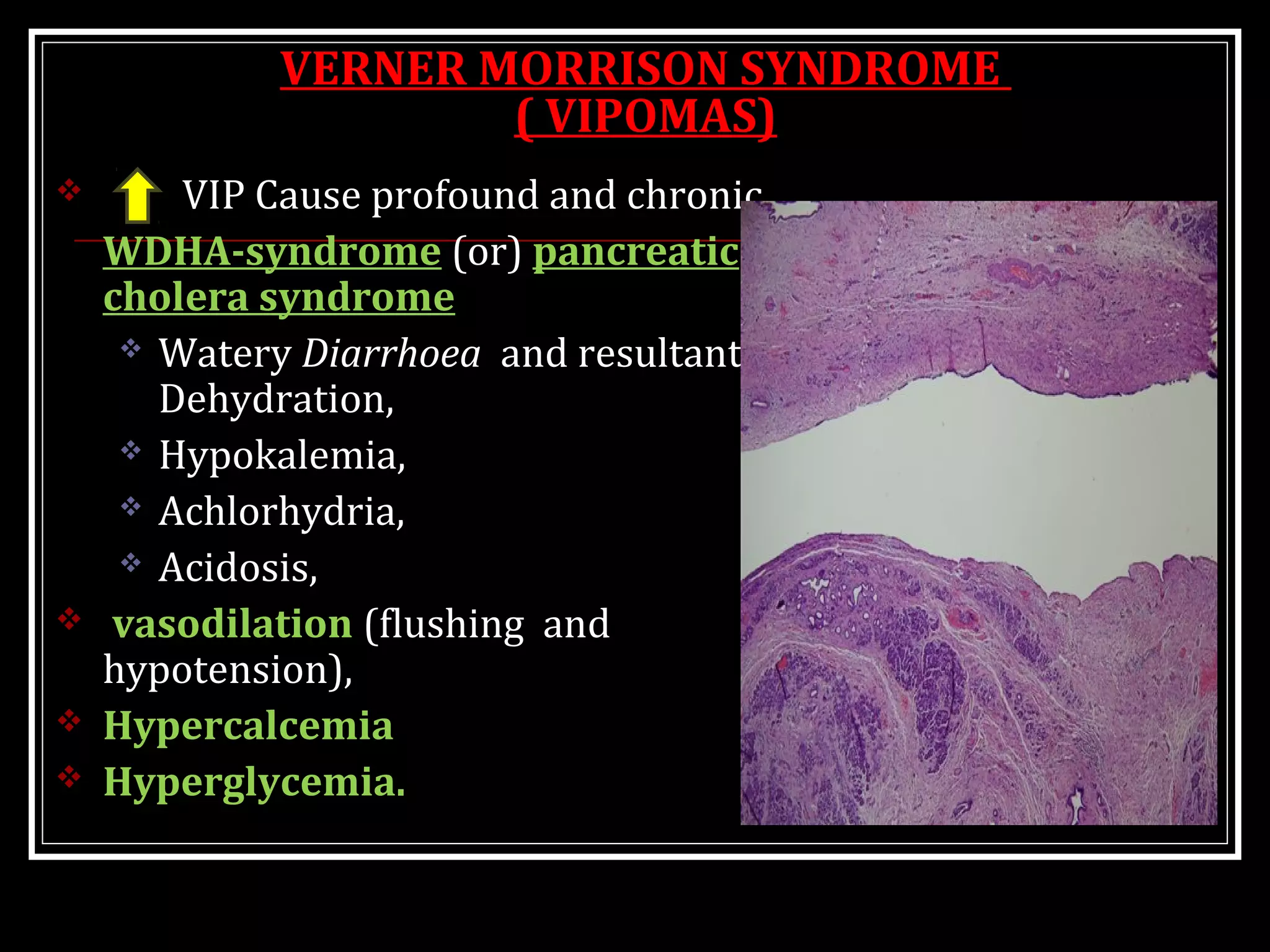 VERNER MORRISON SYNDROME
( VIPOMAS)
 VIP Cause profound and chronic
WDHA-syndrome (or) pancreatic
cholera syndrome
 Watery Diarrhoea and resultant
Dehydration,
 Hypokalemia,
 Achlorhydria,
 Acidosis,
 vasodilation (flushing and
hypotension),
 Hypercalcemia
 Hyperglycemia.
 