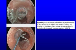 Git j club be management advices22