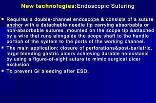 New technologies:New technologies: Endoscopic SuturingEndoscopic Suturing
 Requires a double-channel endoscope & consists of a sutureRequires a double-channel endoscope & consists of a suture
anchor with a detachable needle tip carrying absorbable oranchor with a detachable needle tip carrying absorbable or
non-absorbable sutures ,mounted on the scope tip &attachednon-absorbable sutures ,mounted on the scope tip &attached
by a wire that runs alongside the scope shaft to the handleby a wire that runs alongside the scope shaft to the handle
portion of the system to the ports of the working channel.portion of the system to the ports of the working channel.
 The main application; closure of perforations&post-bariatric,The main application; closure of perforations&post-bariatric,
large bleeding gastric ulcers achieving durable hemostasislarge bleeding gastric ulcers achieving durable hemostasis
by using a figure-of-eight suture to mimic surgical ulcerby using a figure-of-eight suture to mimic surgical ulcer
exclusionexclusion
 To prevent GI bleeding after ESD.To prevent GI bleeding after ESD.
 