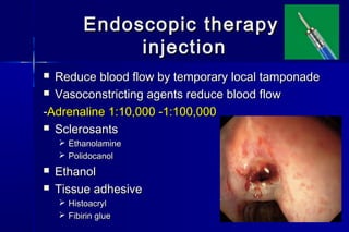 Endoscopic therapyEndoscopic therapy
injectioninjection
 Reduce blood flow by temporary local tamponadeReduce blood flow by temporary local tamponade
 Vasoconstricting agents reduce blood flowVasoconstricting agents reduce blood flow
--Adrenaline 1:10,000 -1:100,000Adrenaline 1:10,000 -1:100,000
 SclerosantsSclerosants
 EthanolamineEthanolamine
 PolidocanolPolidocanol
 EthanolEthanol
 Tissue adhesiveTissue adhesive
 HistoacrylHistoacryl
 Fibirin glueFibirin glue
 