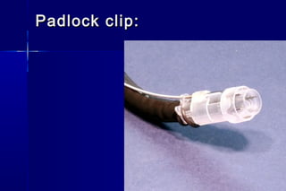 Padlock clip:Padlock clip:
 