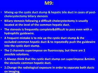 M9:
• Mixing up the cystic duct stump & hepatic bile duct in cases of post-
cholecystectomy biliary stenosis
• Biliary stenosis following a difficult cholecystectomy is usually
located at the level of the common hepatic duct.
• The stenosis is frequently complete&difficult to pass even with a
hydrophilic guidewire.
• A frequent mistake is to mix up the cystic duct stump & the
occluded common hepatic duct & to repeatedly push the guidewire
into the cystic duct stump.
• The 2 channels superimpose on fluoroscopy, but there are 2
possible solutions.
• 1.Always think that the cystic duct stump can superimpose &mimic
the stenotic common hepatic duct.
• 2.Change the radiological exposure in order to separate both ducts
on imaging.
 