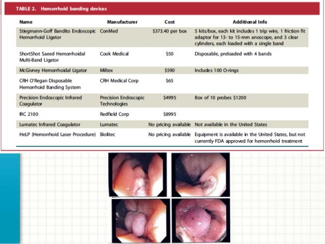 Endoscopic Treatment Of Hemorrhoids With The Help Biolitec System Mitera