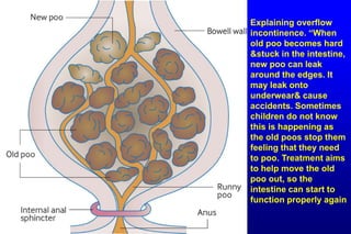 Git j club ped constipation21 | PPTX