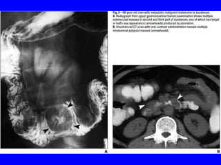 Git j club secondaries.