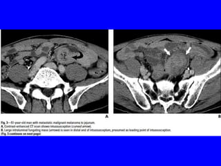 Git j club secondaries.
